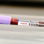Во последните 24 часа во Велика Британија од коронавирус починаа 938 луѓе